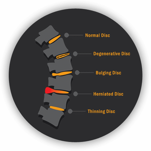 landing page - b1-back-pain-spine-graphic back pain spine graphic